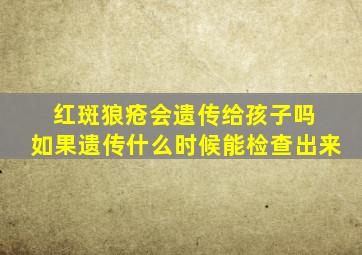 红斑狼疮会遗传给孩子吗 如果遗传什么时候能检查出来